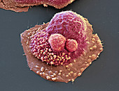 Ovarian cancer cell, SEM