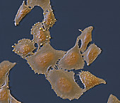 SAOS-2 Osteosarkom 900x - Osteosarkom-Zellen aus Kultur, 900-1