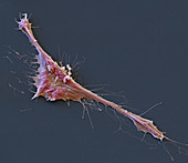 Rhabdomyosarcoma cancer cell, SEM