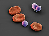 Malariaerreger zwischen Erythrozyten 5000:1