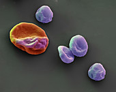 Malariaerreger und infizierter Erythrozyt 7000:1