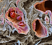 Capillaries and red blood cells, SEM