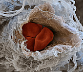 Capillary and red blood cells, SEM