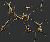 Neuroblastom-Zellen 650:1