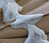 Spider silk on insect prey, SEM
