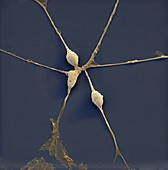 Neuronale Vorlaeuferzelle 1900x - Neuronale Vorläuferzellen, human (Neuronal Progenitor Cells) 1900x