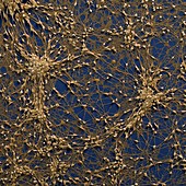 Neuronale Vorlaeuferzelle 240x - Neuronale Vorläuferzellen, human (Neuronal Progenitor Cells) 240x