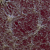 Neuronale Vorlaeuferzelle 240x - Neuronale Vorläuferzellen, human (Neuronal Progenitor Cells) 240x 3