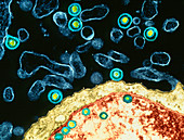 Coloured TEM of herpes virus infecting cells