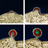 AIDS virus budding from cell, TEM