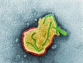 Paramyxovirus particle, TEM