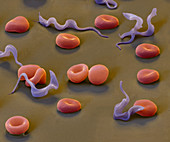 Colour SEM of Trypansoma brucei protozoa in blood