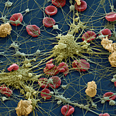 Blutzellen 2000x - Blutzellen 2000-1 2