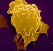 Coloured SEM of human natural killer blood cell