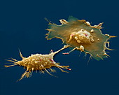 Macrophages engulfing E. coli, SEM