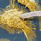 Macrophage attacking parasite, SEM