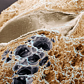 Lung bronchiole and alveoli, SEM