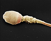 Sperm cell, SEM