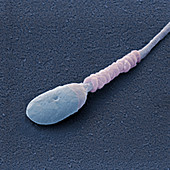 Sperm 12000x - Medizin, Mensch, Spermium