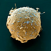 Menschliche Eizelle mit Spermien