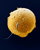 Menschliche Eizelle mit Spermium