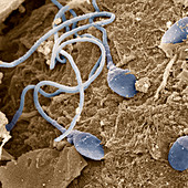 Sperm 6500x - Medizin, Mensch, Spermien