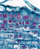 Chromosomen Alli Meta 630x - Chromosomen, Allium, Anaphase