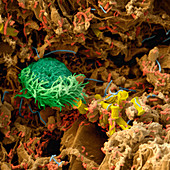 Colour SEM of ciliate and bacteria in compost heap