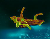 Coloured SEM of the protozoan, Amoeba proteus