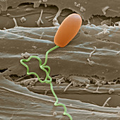 Microsporidium parasite, SEM