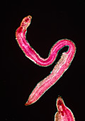 LM of a bilharzia fluke, Schistosoma mansoni