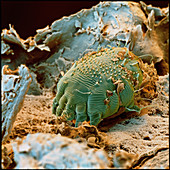 SEM of human itch mite