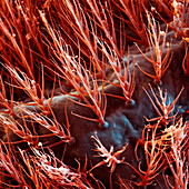 Velvet mite hairs, SEM