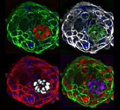 Ten day human embryos, fluorescence micrograph