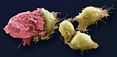 Macrophage and cancer cells, SEM