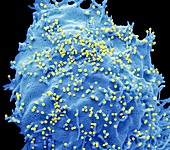 H1N1 flu strain, SEM