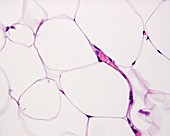 Capillary between fat cells, light micrograph