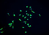 Microglia brain cells, fluorescence micrograph
