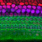 Cochlea cells and stereocilia, light micrograph