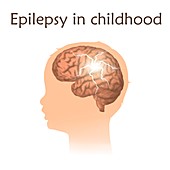 Childhood epilepsy, illustration
