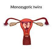 Monozygotic twins, illustration