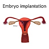 Embryo implantation, illustration