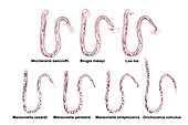Comparison of microfilariae morphology, illustration
