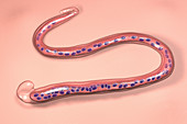 Wuchereria bancrofti parasite, illustration