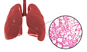 Human lung anatomy and histology, illustration