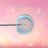 ICSI in vitro fertilisation, illustration