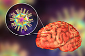 Brain infection caused by Herpes viruses, illustration