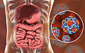 Hepatitis A viruses in intestine, illustration