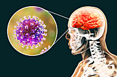 Encephalitis caused by Nipah viruses, illustration