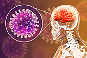 Encephalitis caused by Nipah viruses, illustration
